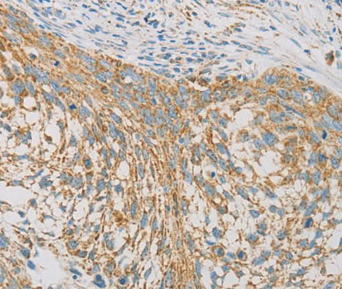 Anti-Human REN Antibody - ABMIUM