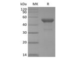 Recombinant Human PVRIG (C-mFc) - ABMIUM