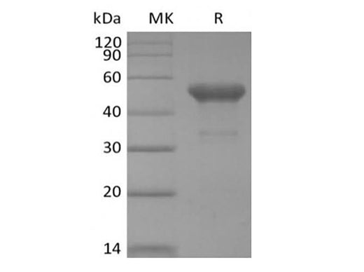 Recombinant Human PVRIG (C-mFc) - ABMIUM