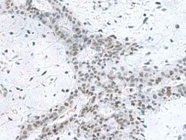 Anti-Human/Mouse/Rat PCLAF Antibody
