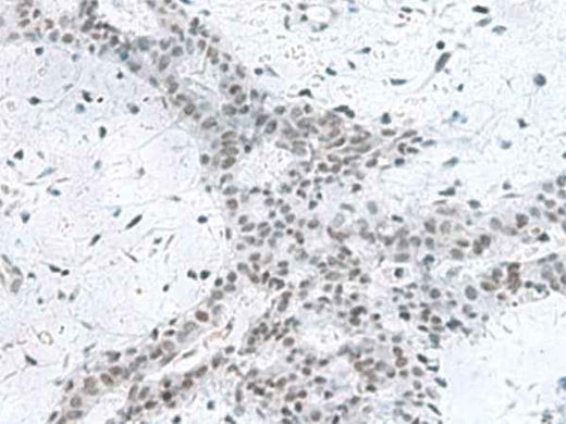 Anti-Human/Mouse/Rat PCLAF Antibody