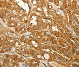 Anti-Human/Mouse/Rat RAB35 Antibody - ABMIUM