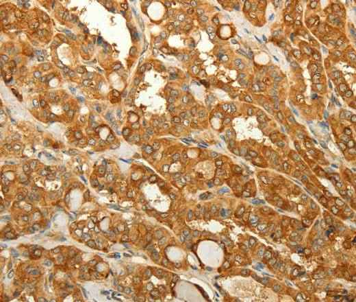 Anti-Human/Mouse/Rat RAB35 Antibody