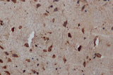Anti-Human/Mouse/Rat PIK3CB Antibody - ABMIUM