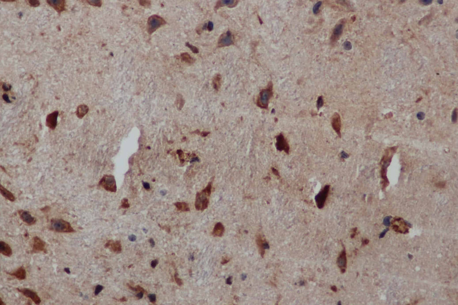 Anti-Human/Mouse/Rat PIK3CB Antibody - ABMIUM