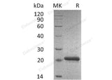Recombinant Mouse TIMP2/TIMP-2 Protein (His Tag) - ABMIUM