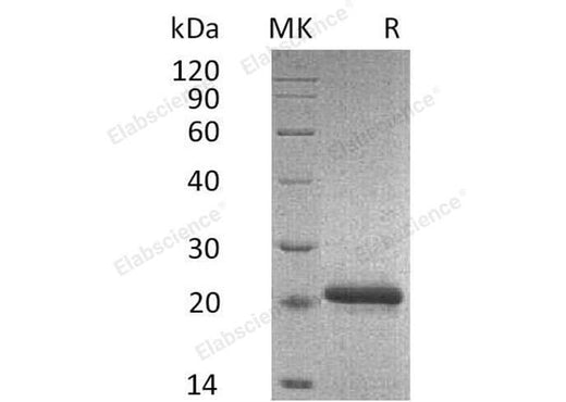 Recombinant Mouse TIMP2/TIMP-2 Protein (His Tag) - ABMIUM