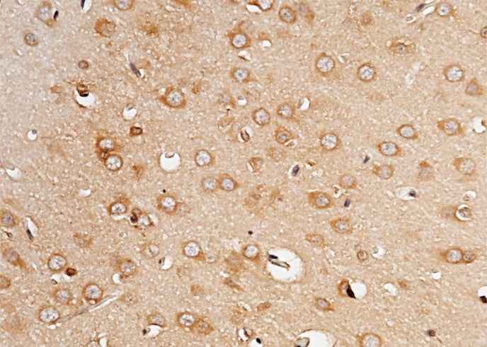 Anti-Rat PCSK9 Antibody [A1103] - ABMIUM