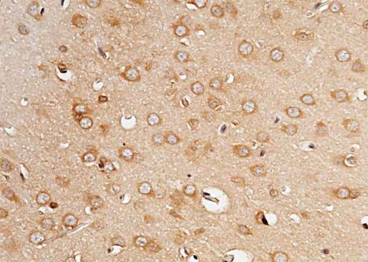 Anti-Rat PCSK9 Antibody [A1103] - ABMIUM