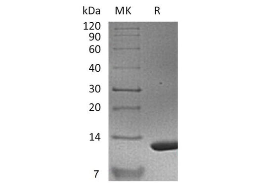 Recombinant Mouse S100A11 Protein (His Tag) - ABMIUM