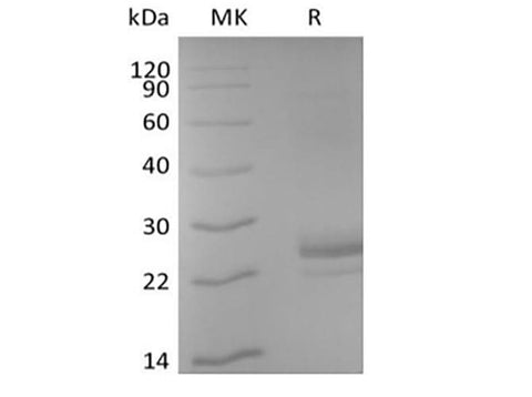 Recombinant Human CD40L/TNFSF5/CD40 Ligand (N-6His-Avi) Biotinylated - ABMIUM