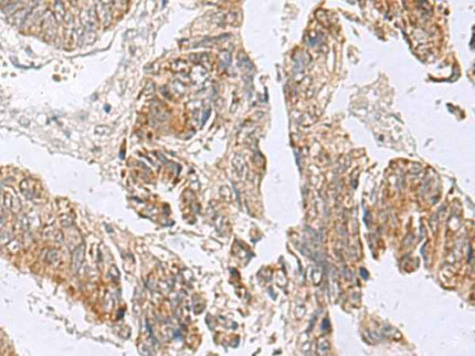 Anti-Human RTKN2 Antibody