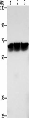 Western blot analysis of Jurkat cells hela cells mouse brain tissue using ZBTB1 Polyclonal Antibody at dilution of 1:500
