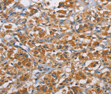 Anti-Human/Mouse RICTOR Antibody - ABMIUM