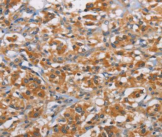 Anti-Human/Mouse RICTOR Antibody