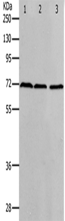 Anti-Human/Mouse/Rat PRMT5 Antibody - ABMIUM