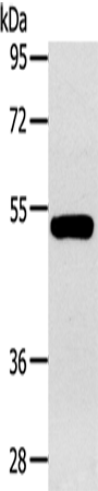 Anti-Human GJA9 Antibody - ABMIUM