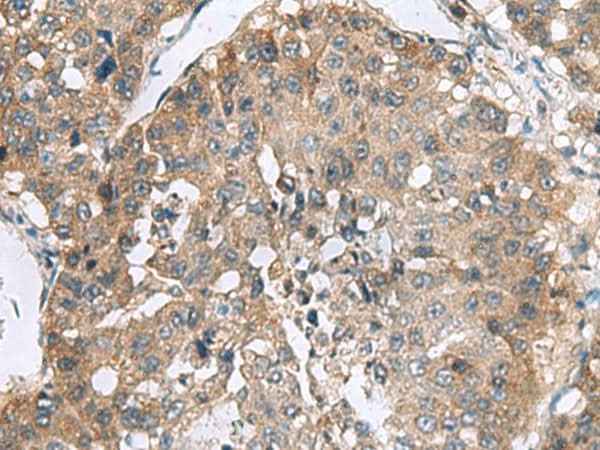 Anti-Human/Mouse/Rat RPL18 Antibody