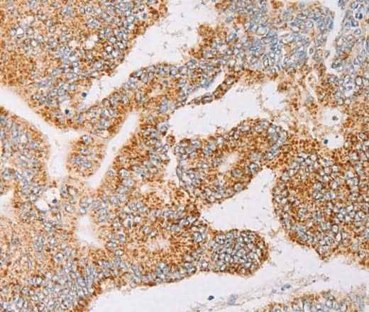 Anti-Human/Mouse/Rat YARS2 Antibody