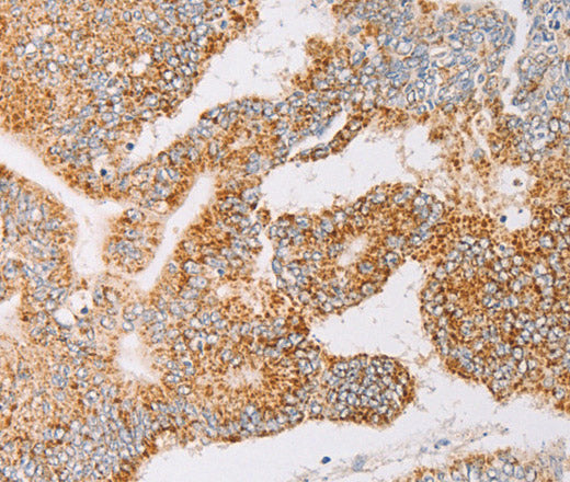 Anti-Human/Mouse/Rat YARS2 Antibody - ABMIUM