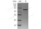 Recombinant Human NDRG1 Protein (His Tag) - ABMIUM