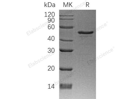 Recombinant Human NDRG1 Protein (His Tag) - ABMIUM