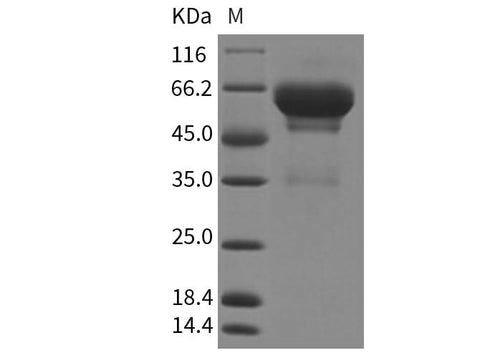 Recombinant Mouse SCG3/Secretogranin 3 Protein (His Tag) - ABMIUM