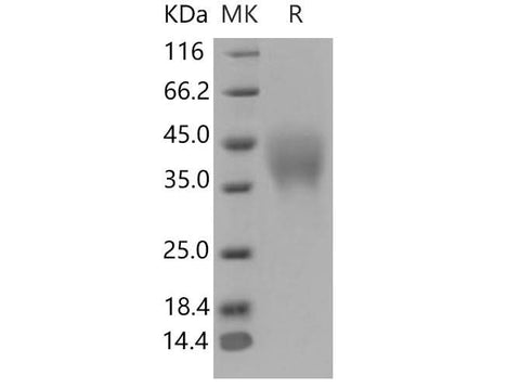 > 97 % as determined by reducing SDS-PAGE.