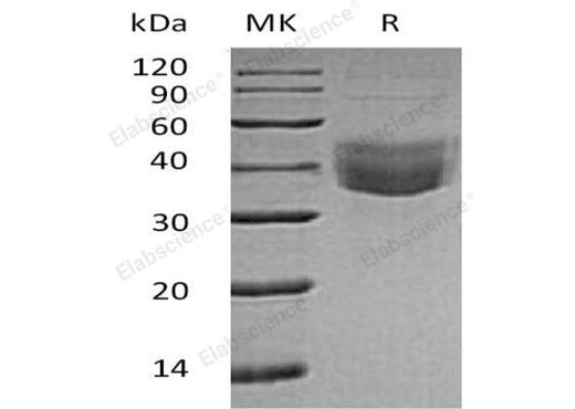 Recombinant Human CLEC10A/CD301 Protein (His Tag) - ABMIUM