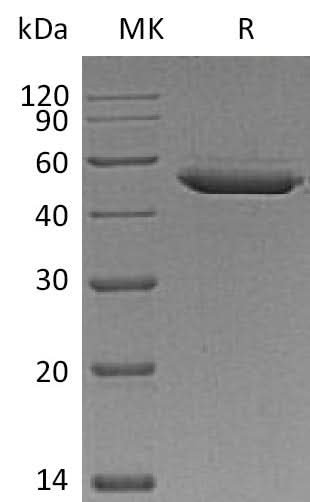 Recombinant Mouse SerpinE2/SERPINE2 Protein (His Tag) - ABMIUM