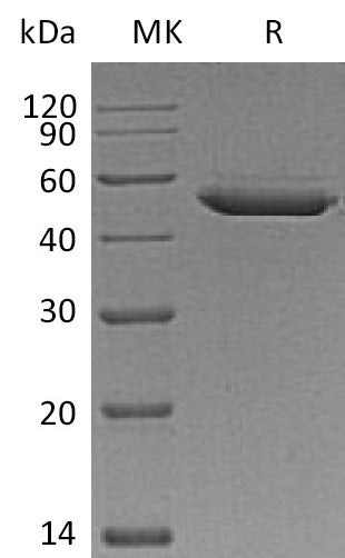 Recombinant Mouse SerpinE2/SERPINE2 Protein (His Tag) - ABMIUM