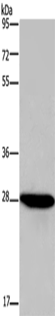 Anti-Human/Mouse/Rat FGF17 Antibody - ABMIUM