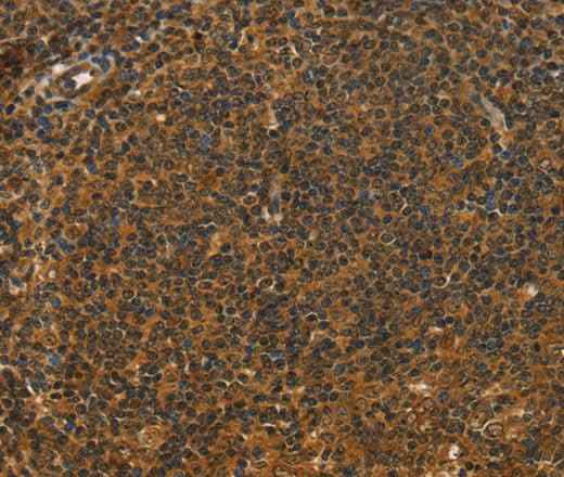 Anti-Human/Mouse/Rat STAR Antibody