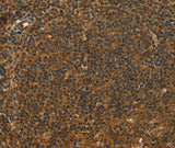 Anti-Human/Mouse/Rat STAR Antibody - ABMIUM