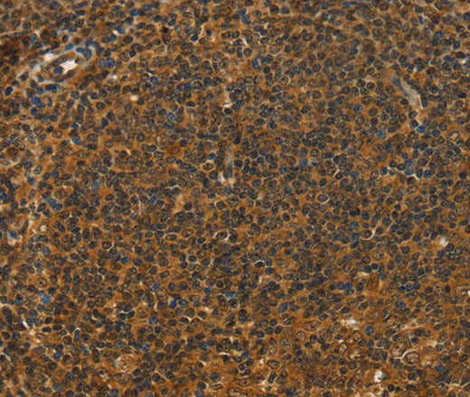 Anti-Human/Mouse/Rat STAR Antibody - ABMIUM
