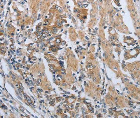 Anti-Human PDCD1 Antibody