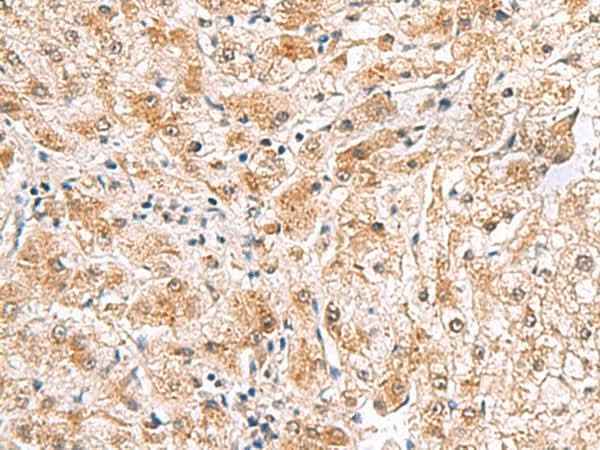 Anti-Human/Mouse PDCL2 Antibody