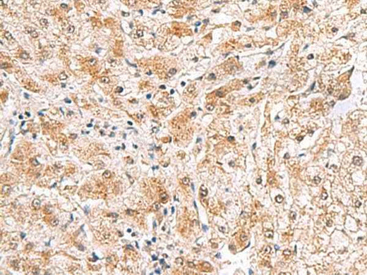 Anti-Human/Mouse PDCL2 Antibody