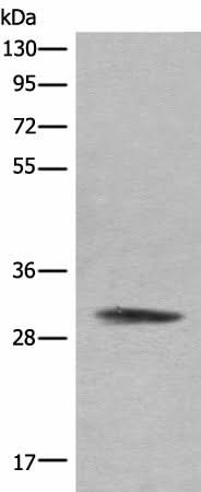 Western blot analysis of Hela cell lysate using COMT Polyclonal Antibody at dilution of 1:450