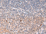 Immunohistochemistry of paraffin-embedded Human tonsil tissue using IFNA1:IFNA13 Polyclonal Antibody at dilution of 1:35(×200)