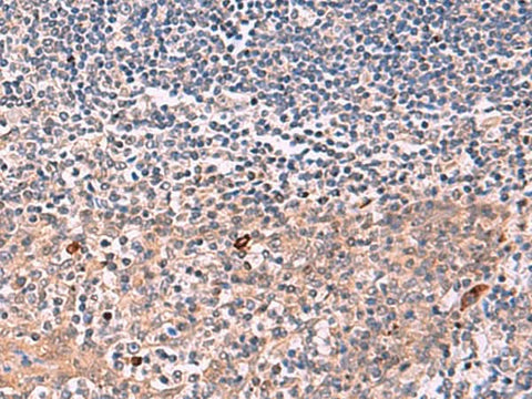 Immunohistochemistry of paraffin-embedded Human tonsil tissue using IFNA1:IFNA13 Polyclonal Antibody at dilution of 1:35(×200)
