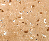 Anti-Human/Mouse TNN Antibody - ABMIUM
