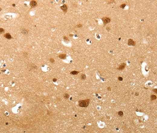 Anti-Human/Mouse TNN Antibody