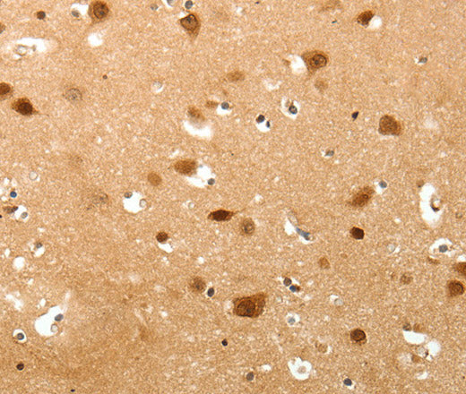 Anti-Human/Mouse TNN Antibody - ABMIUM