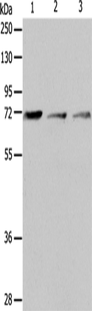 Anti-Human/Mouse IL18RAP Antibody - ABMIUM