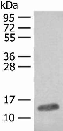 Anti-Human/Mouse/Rat FABP4 Antibody