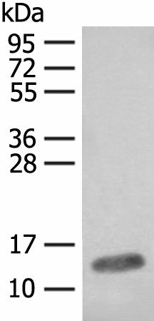 Western blot analysis of Mouse heart tissue lysate using FABP4 Polyclonal Antibody at dilution of 1:400