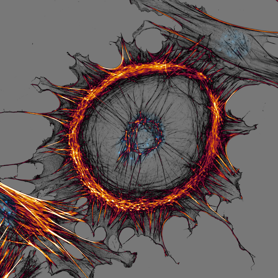 Primary Mouse Embryonic Fibroblast (MEF)