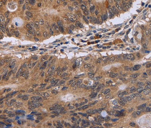 Anti-Human/Mouse/Rat EIF3H Antibody - ABMIUM