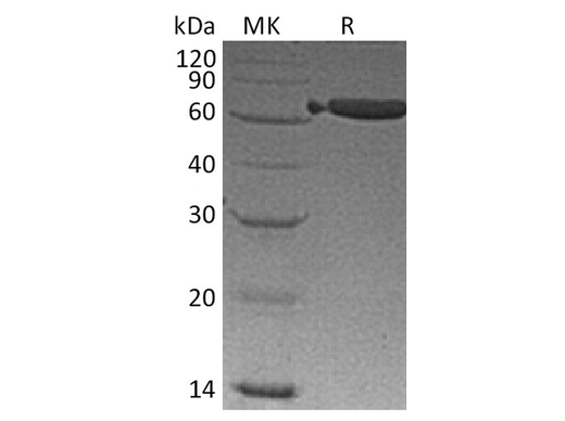 Recombinant Mouse EpCAM/TROP-1 Protein (Fc Tag) - ABMIUM